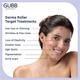 Gubb Derma Roller 540 Needles 0.5 mm 1's - Derma Rollers