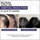 NOVEGROW NUTRI NUTRACEUTICAL Tablet 10's - Hair Loss-Oda