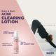 Sanfe Back & Bum Acne Clearing Lotion - Shea Butter & Peach Extracts 100 ml - Lotions & Creams