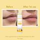 WishCare Ceramide Lip Balm with SPF50 PA+++ - Kojic Acid & Niacinamide - For Lip Lightening 5 gm - Lip Balms