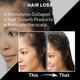 House of Beauty Derma Roller 1.00Mm For Home Use, Reduces Hairfall, Balding & Stretchmarks 1's - Derma Rollers