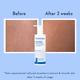 Wishcare AHA + BHA Exfoliating Body Lotion-Provides Deep Hydration & Detan Skin (200ml) - Lotions & Creams