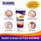Scarnil Cream 50 g - Wound/Burns