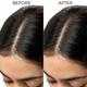Brillare Lactylate Shampoo for itchy, flacky & dandruff prone Scalp 200 ml - Shampoos