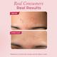 The Pink Foundry Overnight Acne Spot Corrector 15 ml - Skin-Treatment