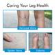 AccuSure Varicose Vein Stockings (XXL) 1's - Knee/Leg Supports