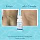 Wishcare Aqua Fresh Underarm Roll On Serum - Reduces Pigmentation & Prevents Body Odour (50ml) - Deodorants/Roll-Ons