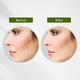 Lotus Botanicals Neem, Tulsi, Salicylic Acid Anti-Acne Purifying Face Gel, For Acne Prone Skin 50 gm - Face Moisturizers