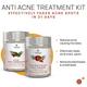 The Tribe Concepts Anti Acne Treatment Kit - With Steel Tin 150 gm - Loose Powder