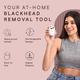 Winston Blackhead Remover Acne Pore Cleanser 1's - Others