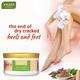 Vaadi Herbals Foot Cream - Clove Oil & Sandalwood 150 gm - Foot Creams & Lotions