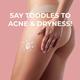 Sanfe Back & Bum Acne Clearing Lotion - Shea Butter & Peach Extracts 100 ml - Lotions & Creams