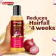 Baidyanath Red Onion Hair Oil 200 ml - Speciality Medicines