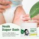 Mother Sparsh Plant Powered Baby Diaper Rash Cream 50 gm - Rash Creams