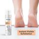 Protouch Callus Remover Spray, Potent Formula to Remove the Tough Dead skin and Reveal Soft Heels 100 ml - Foot Scrubs