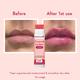 WishCare Tinted Ceramide Lip Balm with SPF50 PA+++ - Kojic Acid & Niacinamide - For Lip Lightening 5 gm - Lip Balms
