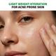 Novology Acne Light Moisturizing Gel for Oily, Acne Prone Skin - Upto 100 Hours of Hydration 50 gm - Face Moisturizers