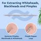 Gubb Pimple & Blackhead Remover Precies Smooth 1's - Others