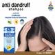 Allen Arnica Plus S Anti Dandruff Shampoo 100 ml - Personal Care(Homeopathy)