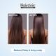 Haironic Salicylic Acid Oil & Flake Control Hair Serum 100 ml - Hair Treatment