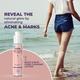 Sanfe Back & Bum Acne Clearing Lotion - Shea Butter & Peach Extracts 100 ml - Lotions & Creams