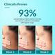 Fixderma Nigrifix Cream For Dark Neck, Ankles, Knuckles, Elbows, Underarm Whitening (50 g) - Lotions & Creams