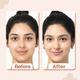 The Derma Co. 2% Niacinamide High Coverage Foundation, 1% Hyaluronic Acid and SPF 40 PA+++ for 12 Hr - 02 Nude 30 gm - Foundation