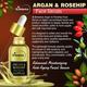 St.Botanica Argan & Rosehip Face Serum 30 ml - Dark Circle & Wrinkle Busters
