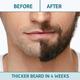 Bombay Shaving Company 4 Step Beard Growth Kit 450 gm - Beard Kits