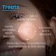FCL PBA Brightening Face Mask Kojic Acid With Hyaluronic Acid for Glowing Skin 100 gm - Face Packs