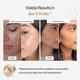 Beautywise Advanced Collagen Peptides (Unflovoured) 200 gm - Multi-Vitamins