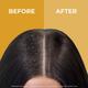 Organic Forest (100% Chemical-Free) Anti Dandruff Hair Oil 100 ml - Hair Oils