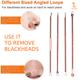 Majestique Blackhead Remover Kit 1's - Facial Kits