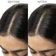 Brillare Dandruff Control Shampoo For Itchy, Flaky Scalp 300 Ml - Shampoos