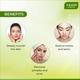 Vaadi Herbals Anti-Acne Aloe Vera Massage Gel 50 gm - Face Gels