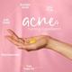 Anveya Goodbye Acne Cleanser For Acne & Pimple Scars Removal 120ml - Face Serum