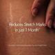 Kapiva Skin Rituals Ghee Kumkumadi Stretch Mark Cream 200 gm - Skin-Treatment