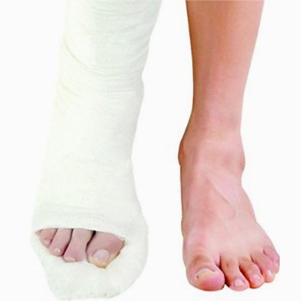 Netmeds | Dynamic Top Cast Plaster of Paris Bandage 2.7M 15 cm (4122-005)