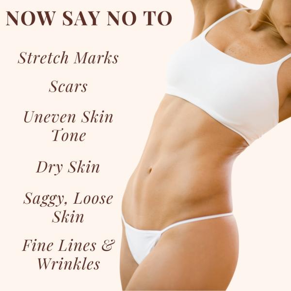 Essentia Extracts Pure Cold Pressed Anti Stretch Marks Oil (Pack of 2 x 100 ml) 1's - Creams/Oils/Lotions