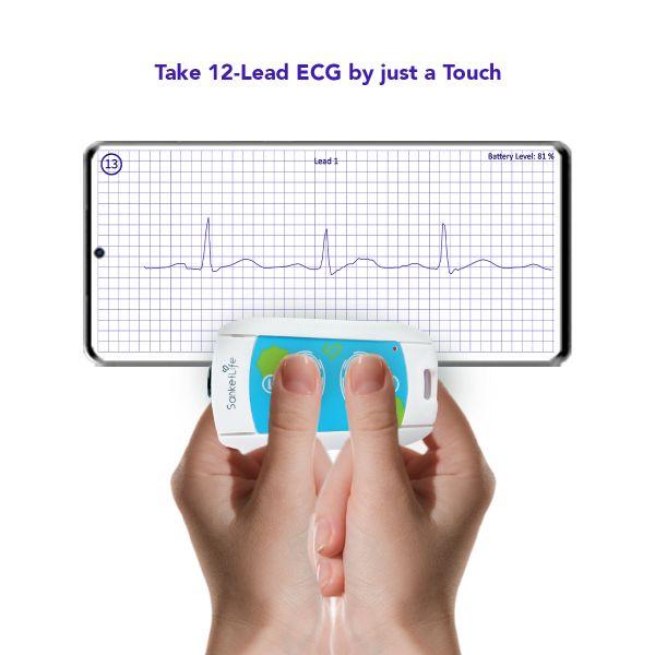 Agatsa SanketLife 2.0 Portable ECG Monitoring Device - Health Monitors And Equipment