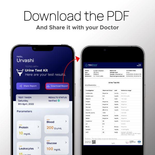 Neodocs Advanced Urine Test Kit (Pack of 3) - Health Monitors And Equipment