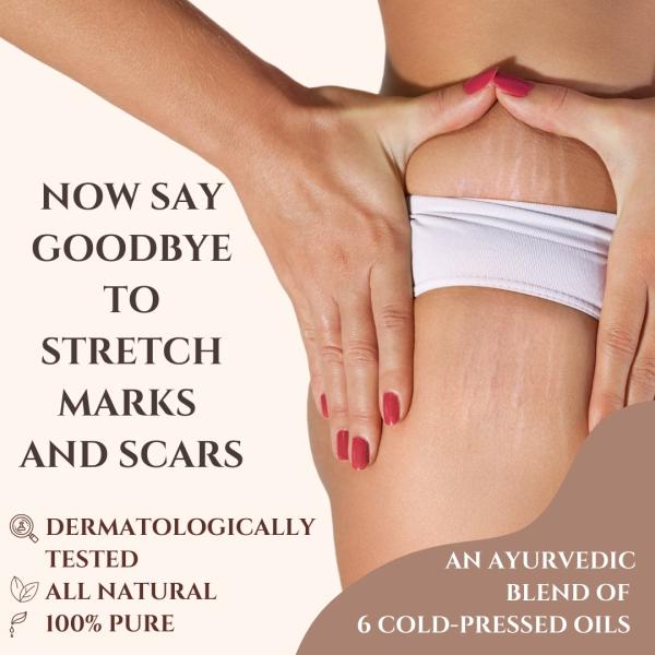 Essentia Extracts Pure Cold Pressed Anti Stretch Marks Oil (Pack of 2 x 100 ml) 1's - Creams/Oils/Lotions