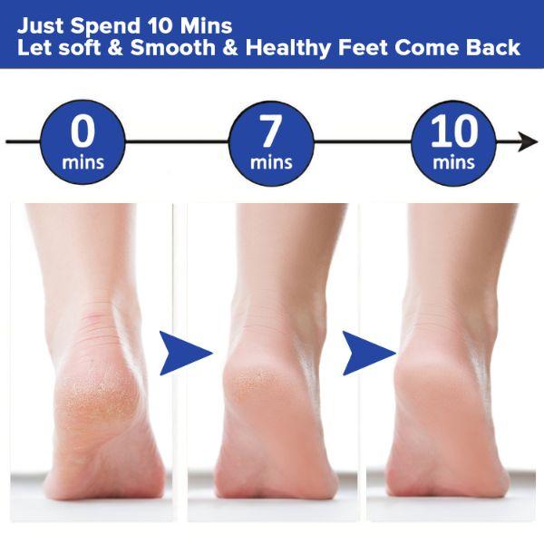 Dr Foot Foot File Callus Remover with Free Brush 1's - Manicure & Pedicure Kits