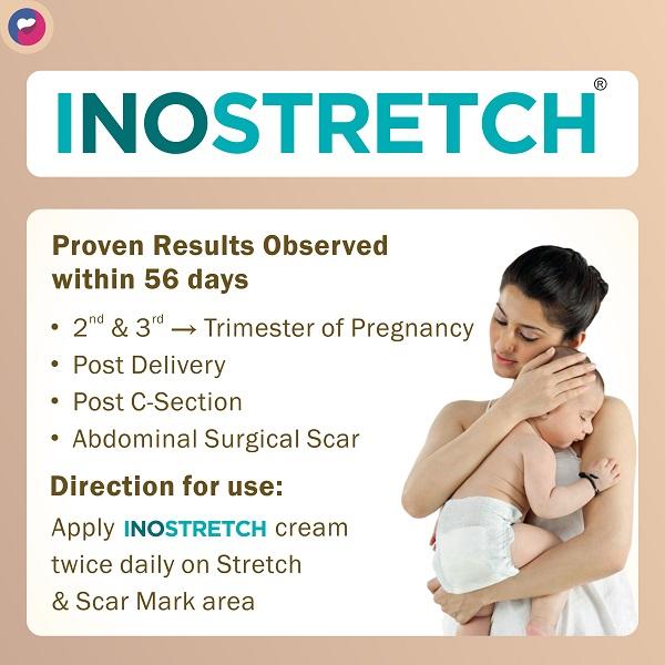 Inostretch Intensive Scar and Anti Stretch Mark Cream 60 gm - Skin-Treatment