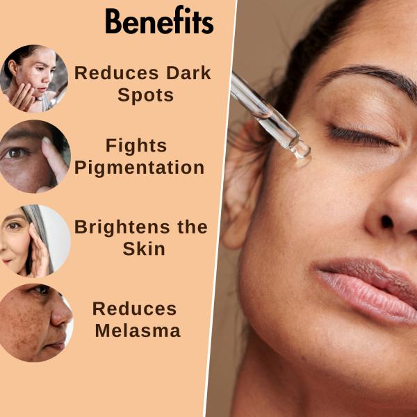 Dermistry No Pigmentation 2% Kojic Acid Skin Perfecting Face Serum 30 ml - Face Serum