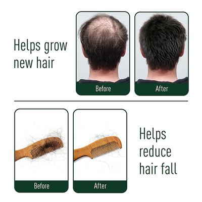 Neem Ayu Effective Ayurveda All Natural Anti Hair Fall Capsule 60's - Hair Treatment