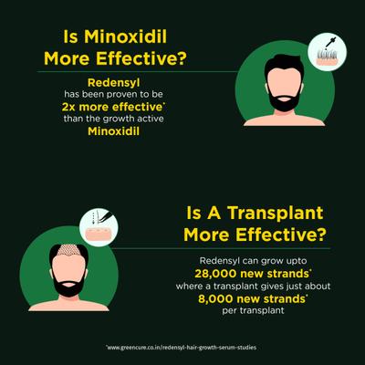 TruHabit Hair Growth Serum 30 ml - Hair Serums