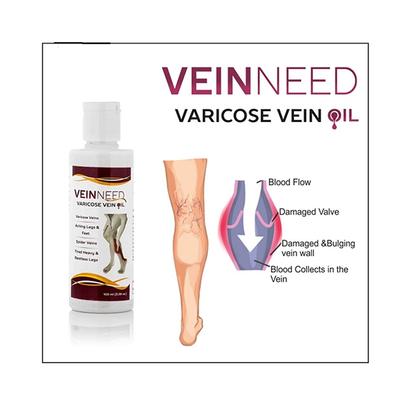 Veinneed Varicose Vein Oil 100 ml - Vital Health