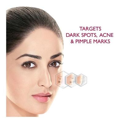 Fair & Lovely Anti Marks Treatment Face Cream 40 gm - Face Creams