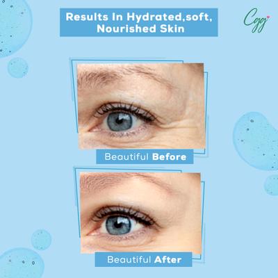 CGG Cosmetics Hydro Boost Cosmetics 2% Hyaluronic Acid Serum 10 ml + CGG Cosmetics Hydro Boost Water Gel 100 gm + CGG Cosmetics Aqua Bomb Watery Sunscreen Cream SPF 50 50 gm 160 gm - Body Sunscreen